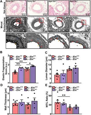 Elastin haploinsufficiency accelerates age-related structural and functional changes in the renal microvasculature and impairment of renal hemodynamics in female mice